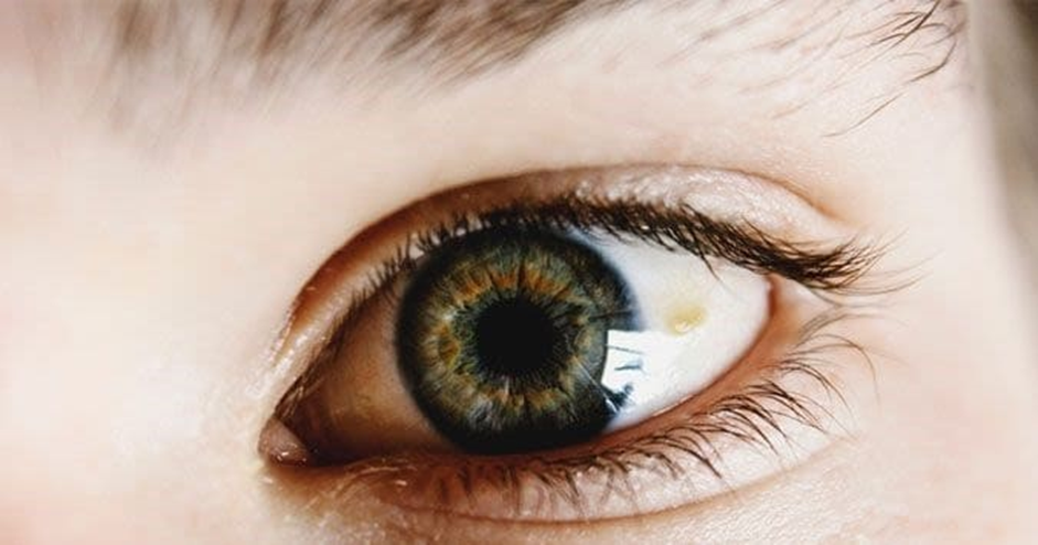 توده زرد روی چشم چیست؟