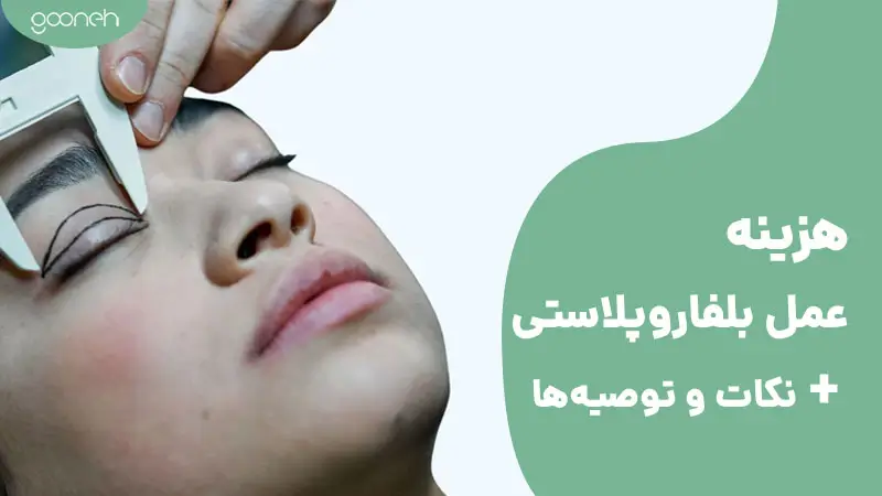 هزینه عمل بلفاروپلاستی
