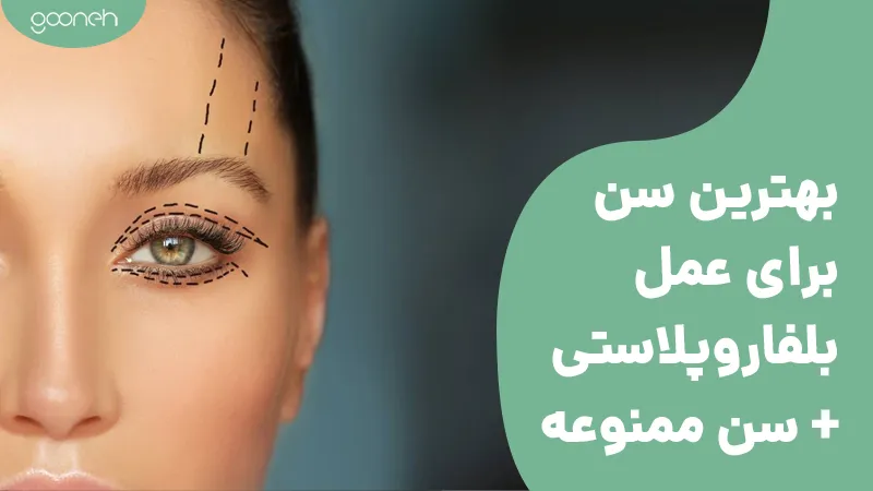 بهترین سن برای جراحی پلک