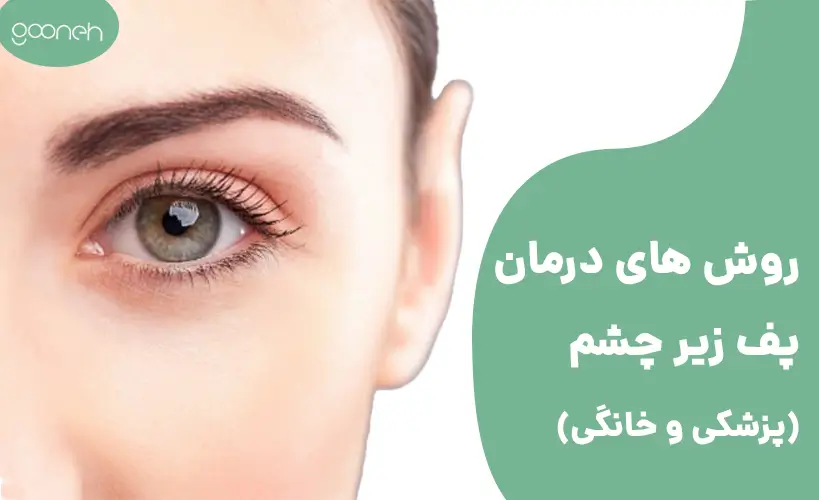علت پف زیر چشم و روش های از بین بردن پف زیر چشم فوری