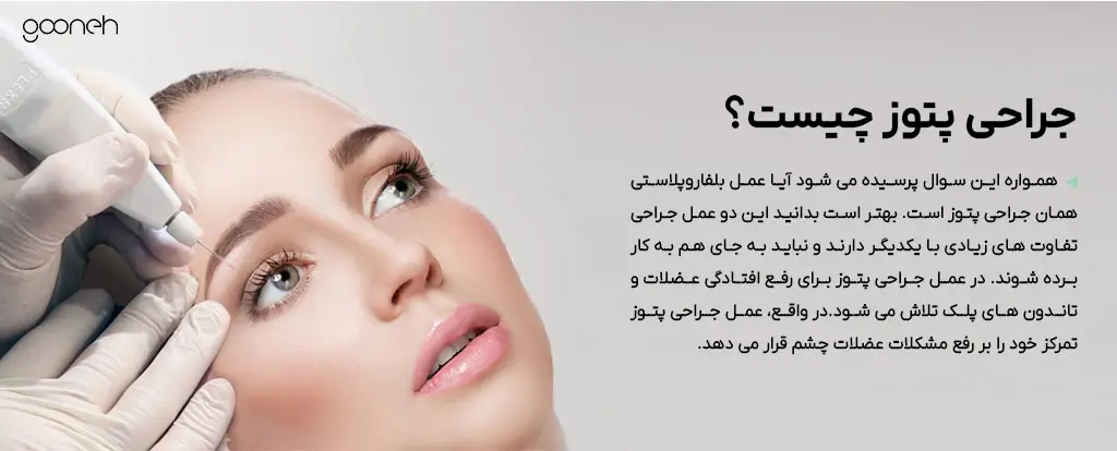 جراحی پتوز چیست؟