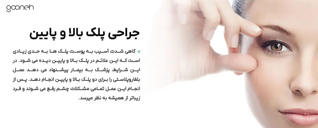 belpharo 4 min جراحی پلک بالا و پایین