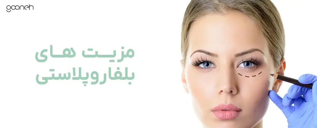 belpharo 6 min مزیت های بلفاروپلاستی