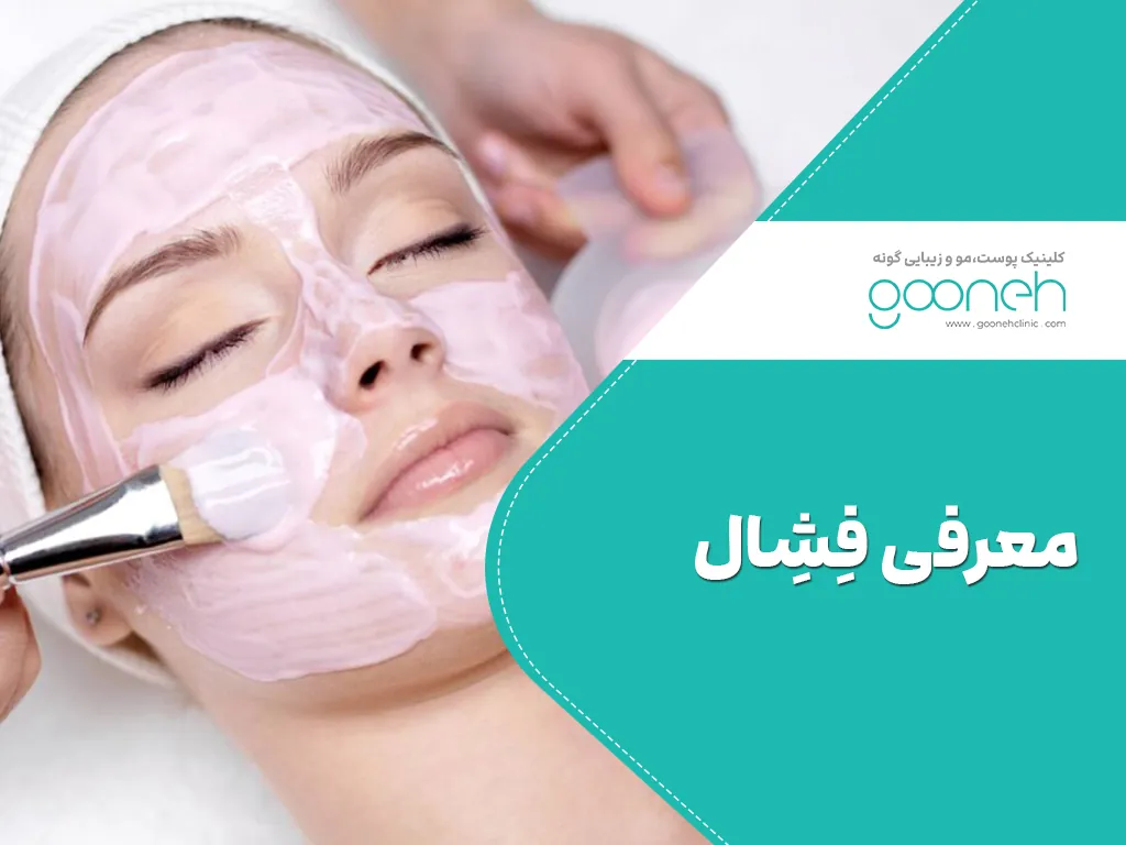 فیشیال چیست
