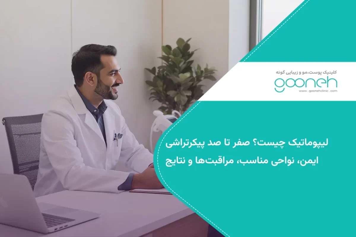 لیپوماتیک چیست