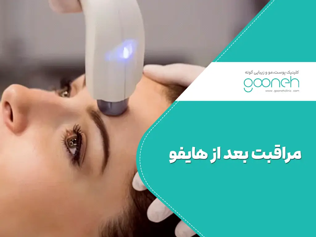 مراقبت بعد از هایفو