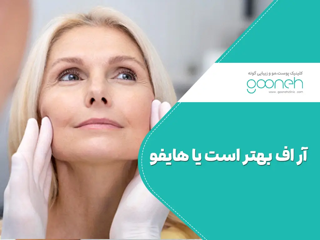 آر اف بهتر است یا هایفو