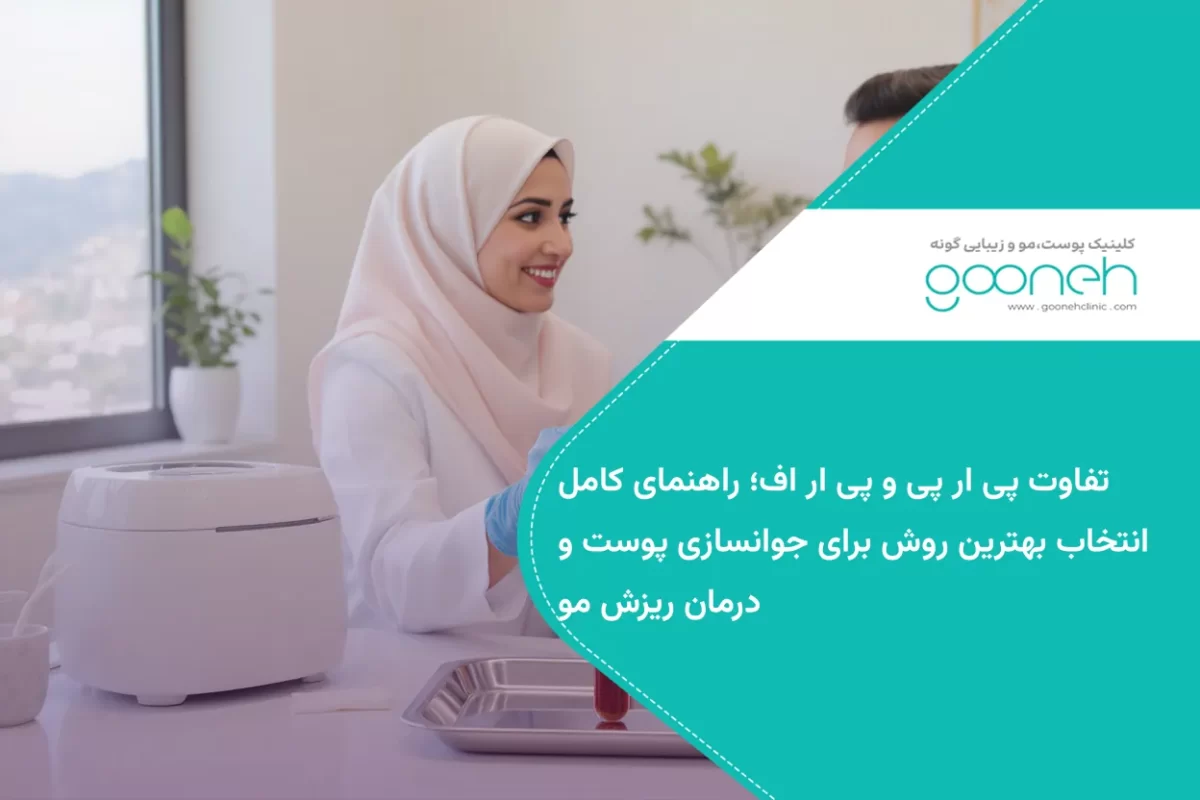 تفاوت پی ار پی و پی ار اف