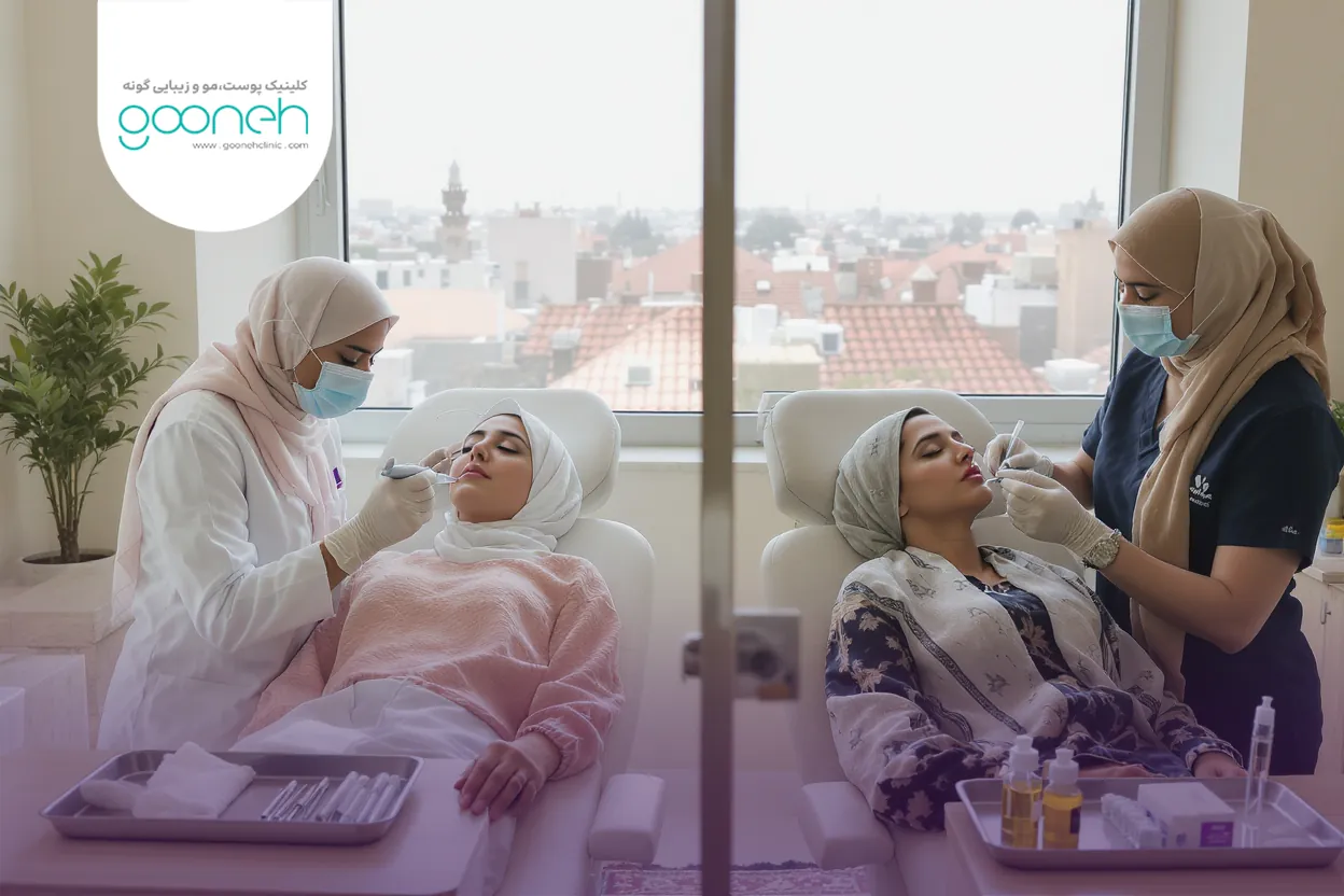 Difference between mesoneedling and mesotherapy تصویر توضیحی از عملکرد سوزنها در مزونیدلینگ و مزوتراپی