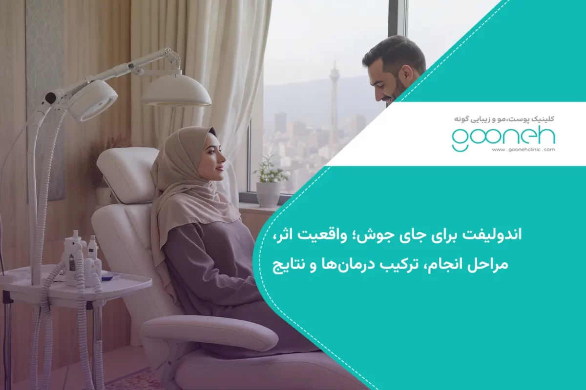 اندولیفت برای جای جوش