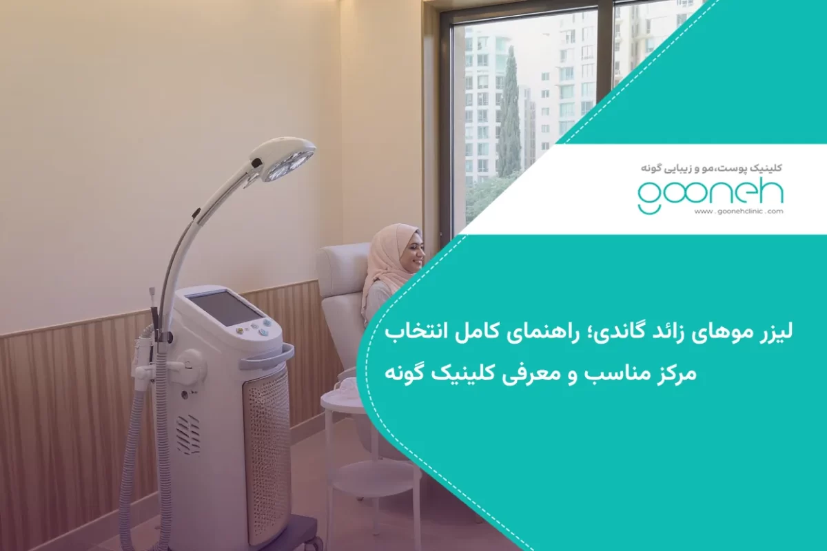 لیزر موهای زائد گاندی