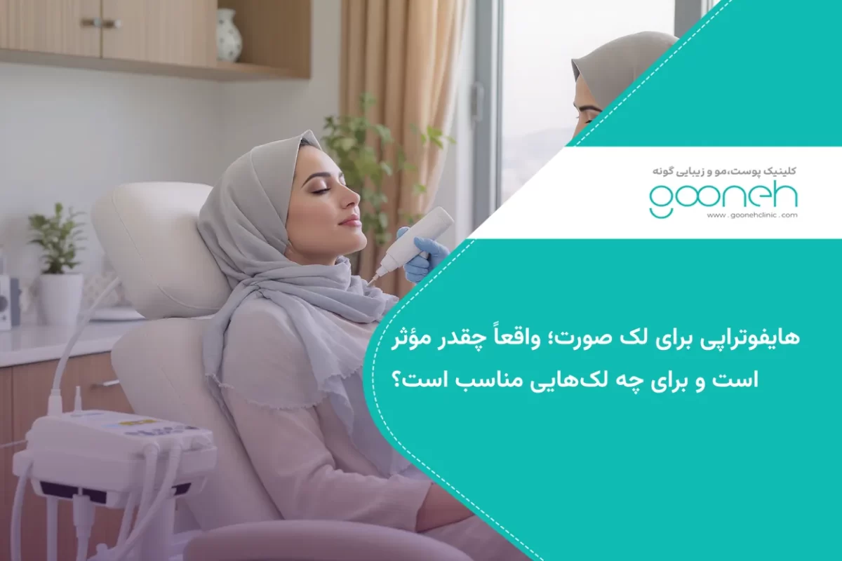 هایفوتراپی برای لک صورت