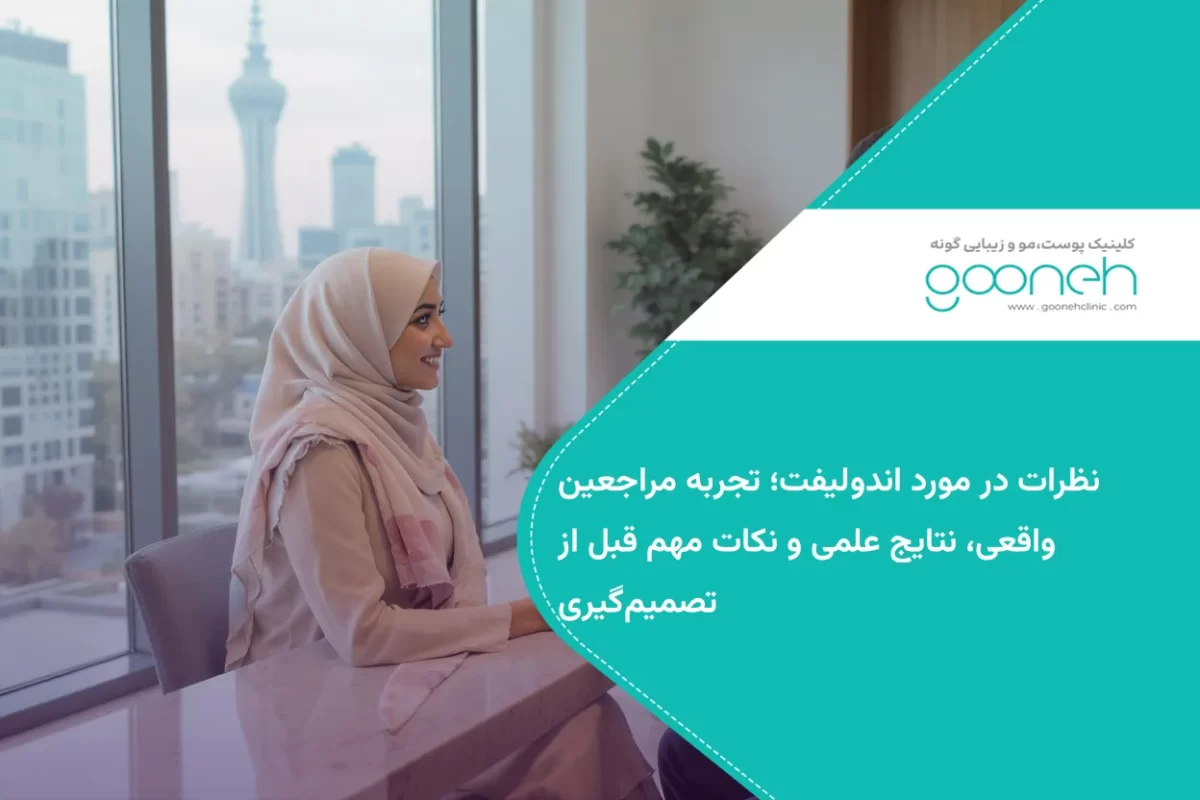 نظرات در مورد اندولیفت