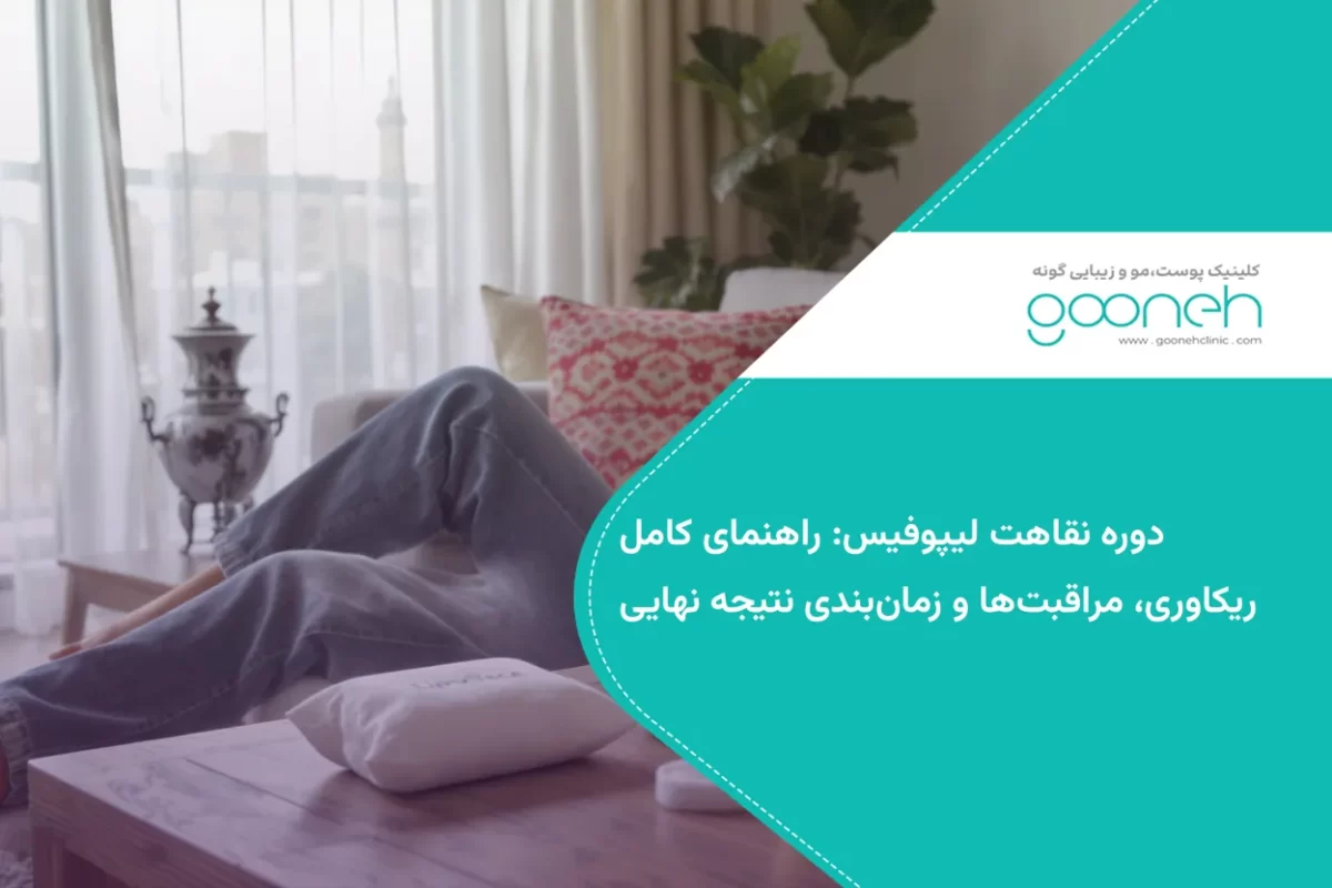 دوره نقاهت لیپوفیس