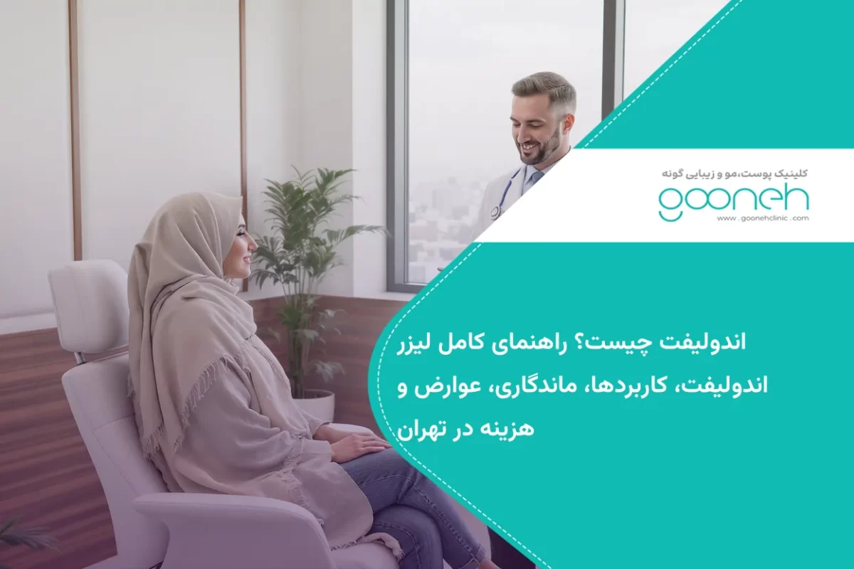 اندوليفت چيست