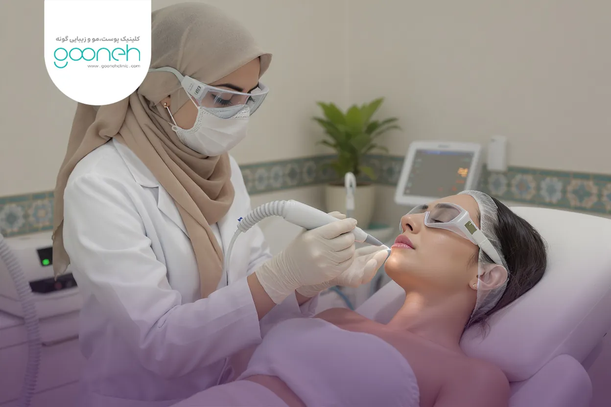 اندوليفت چيست