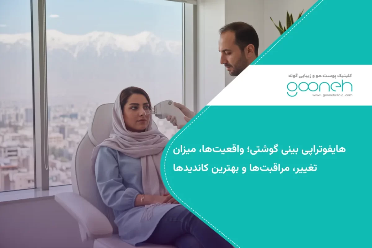 هایفوتراپی بینی گوشتی