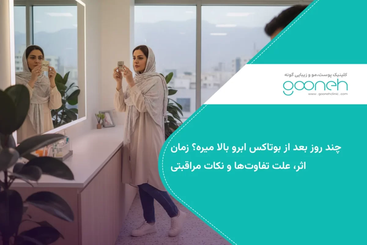 چند روز بعد از بوتاکس ابرو بالا میره