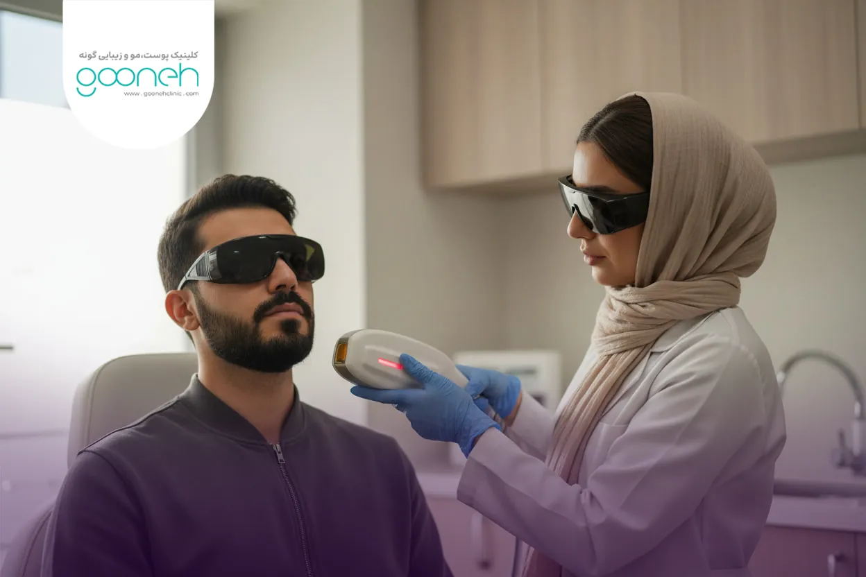 Laser hair removal for men لیزر موهای زائد آقایان برای کاهش موهای ضخیم صورت و بدن