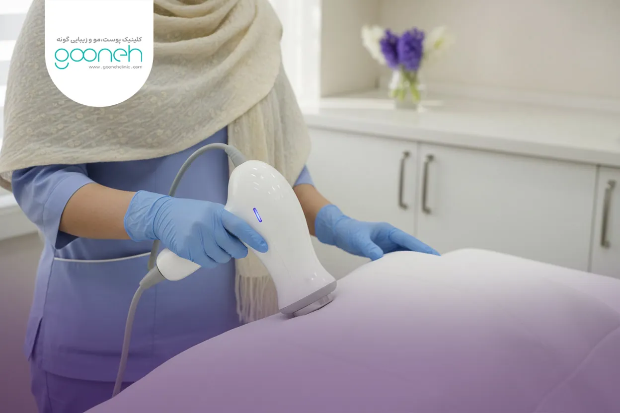 What is abdominal HIFU therapy هایفوتراپی شکم برای کاهش چربی موضعی و سفت شدن پوست