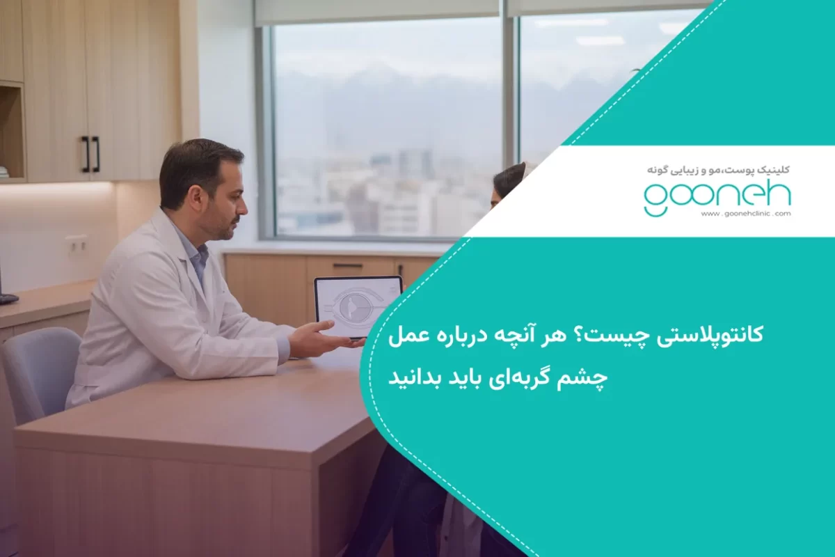 کانتوپلاستی چیست؟