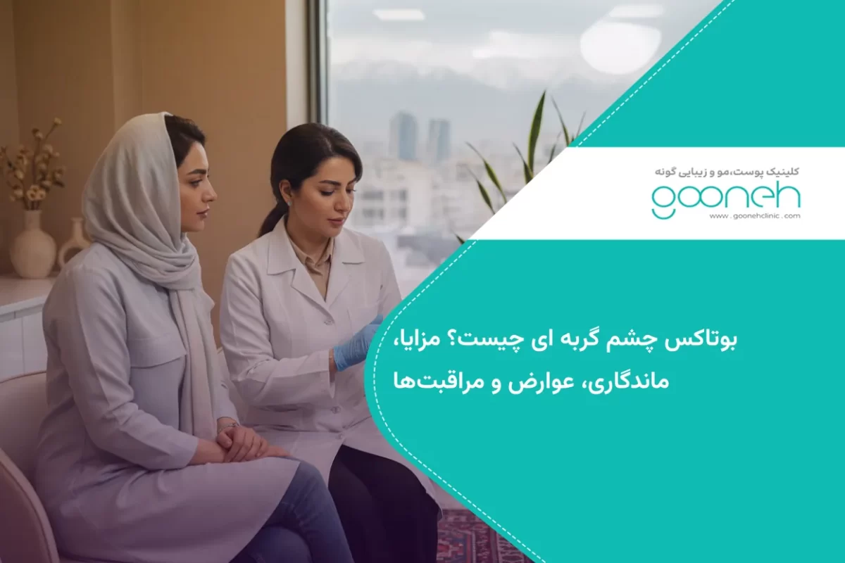 بوتاکس چشم گربه ای چیست