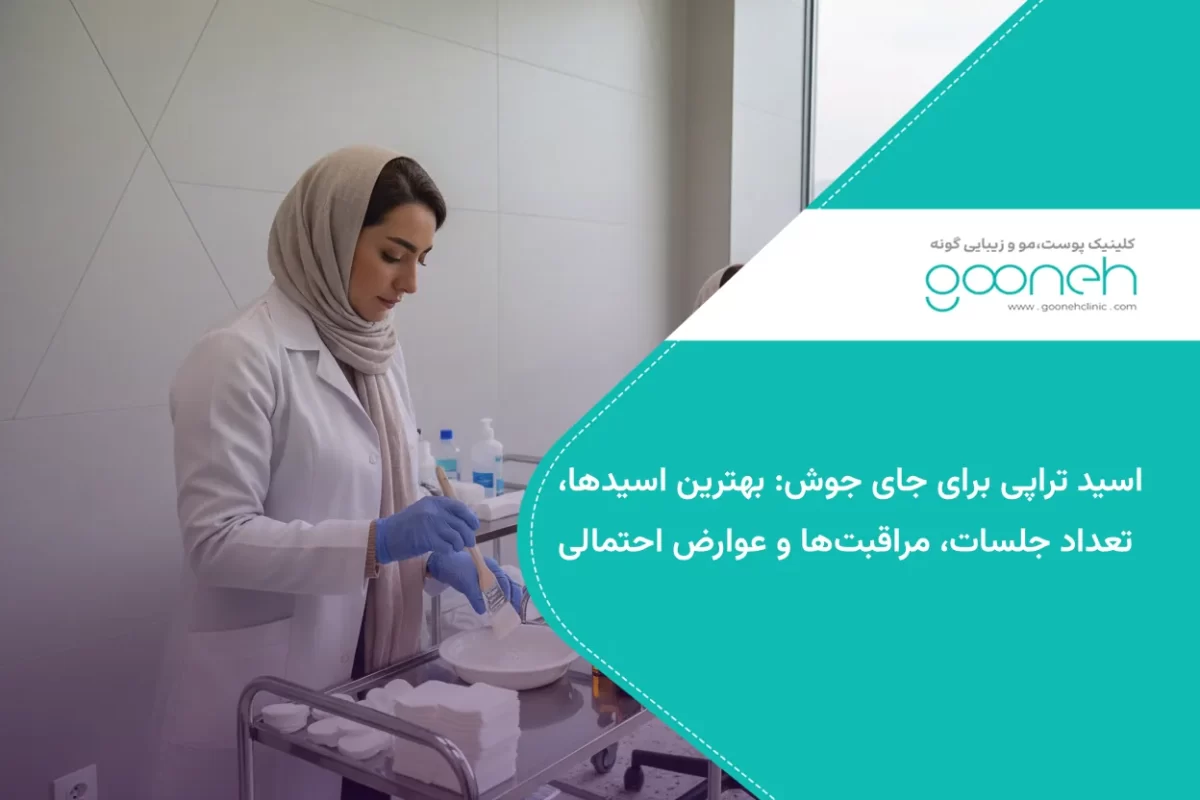 اسید تراپی برای جای جوش