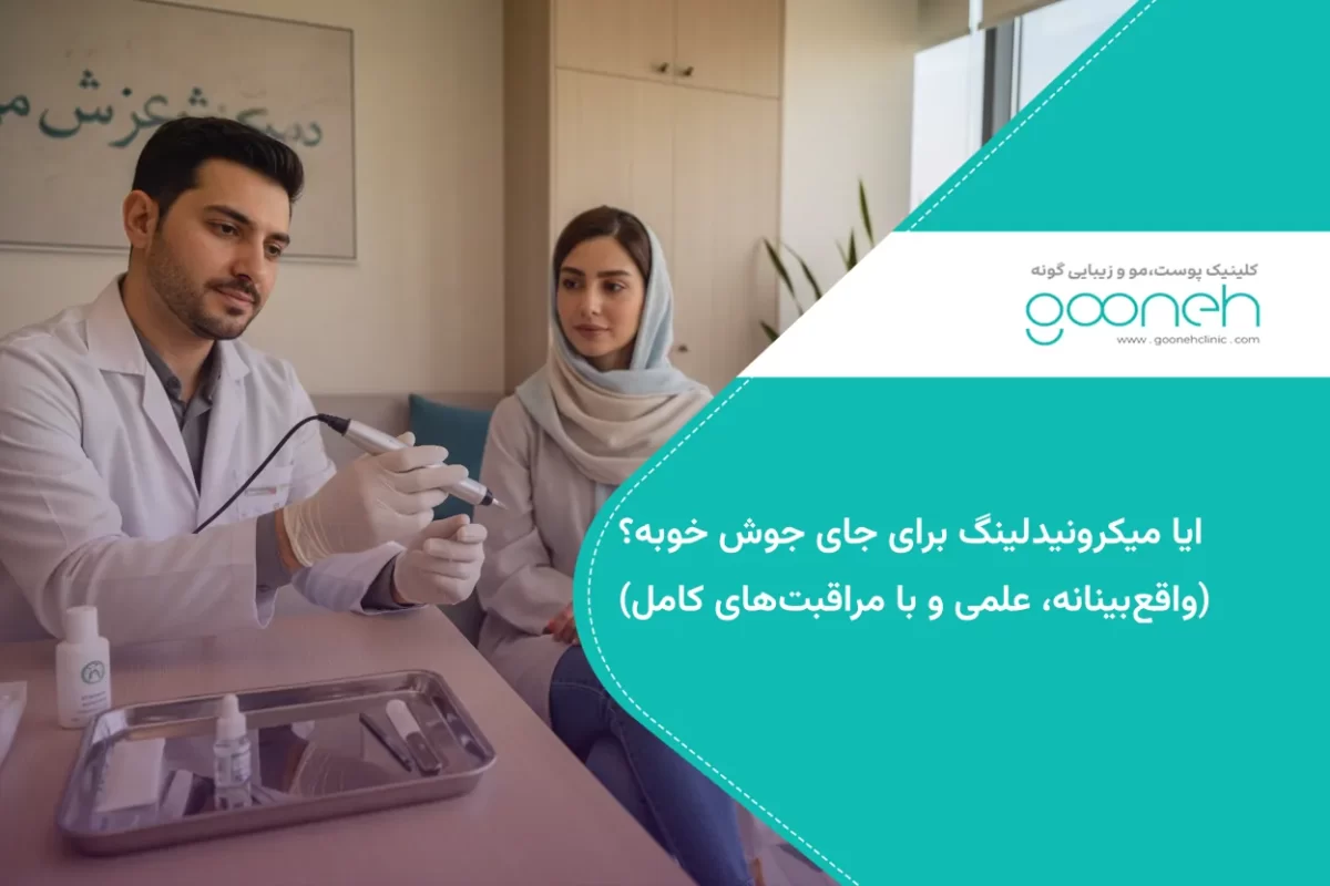 ایا میکرونیدلینگ برای جای جوش خوبه