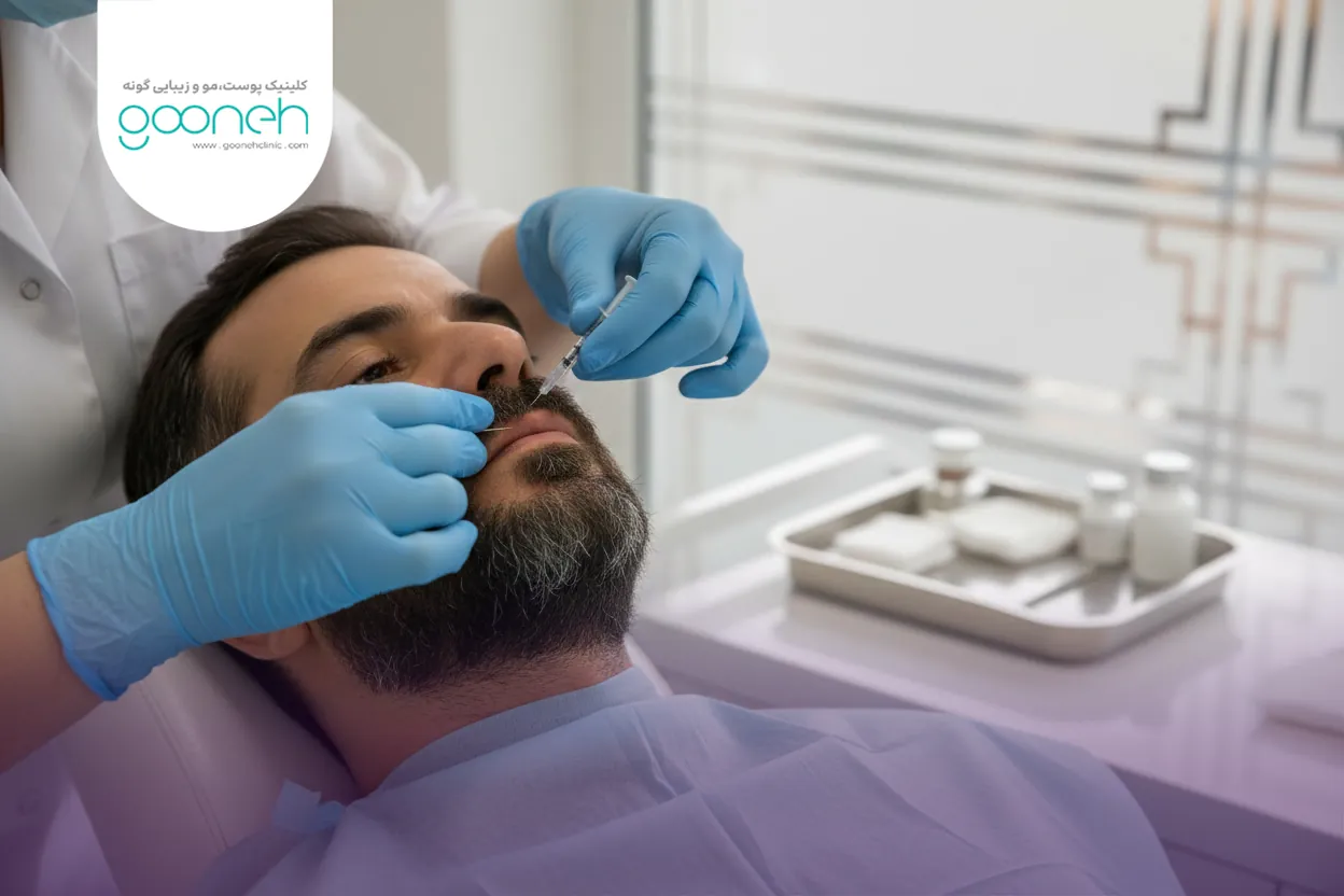 Lip Botox for a gummy smile 3 سوالات متداول بوتاکس لب برای لبخند لثه ای