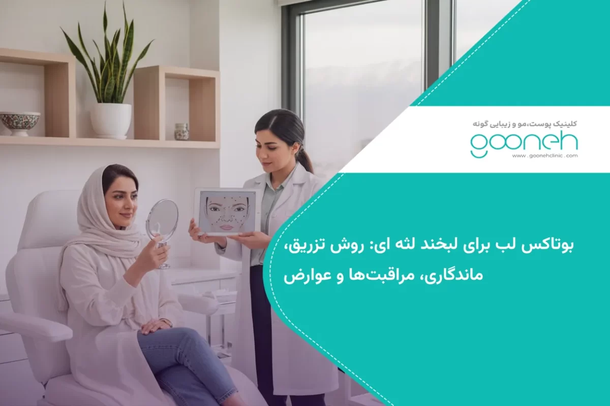 بوتاکس لب برای لبخند لثه ای