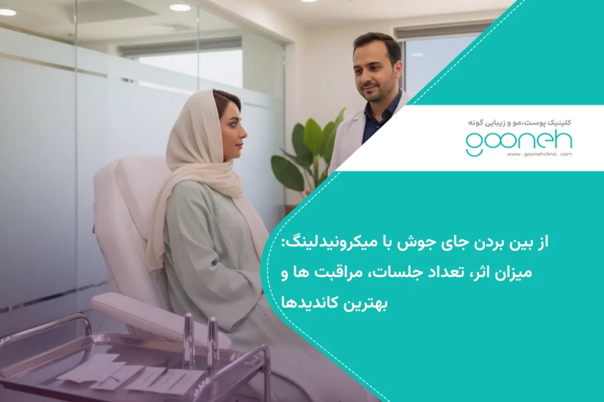 از بین بردن جای جوش با میکرونیدلینگ