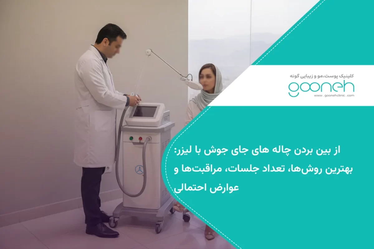 از بین بردن چاله های جای جوش با لیزر