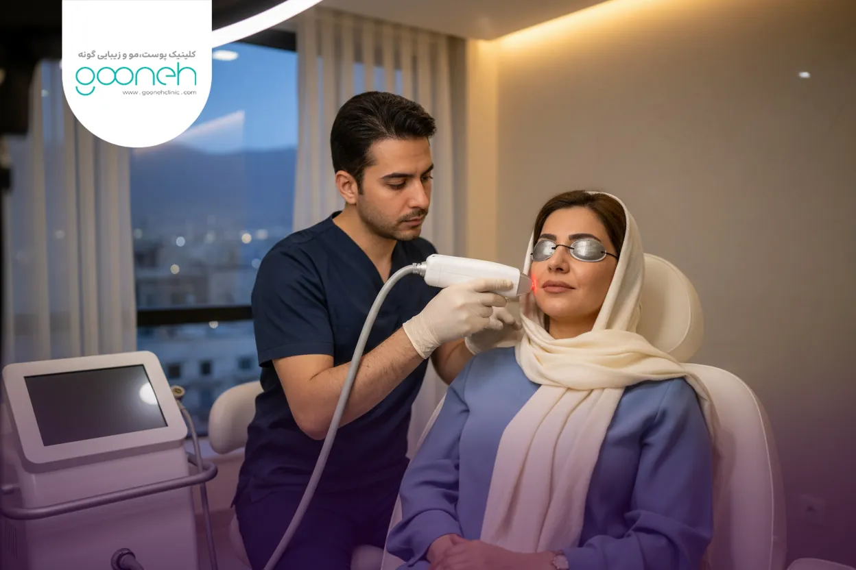 از بین بردن چاله های جای جوش با لیزر