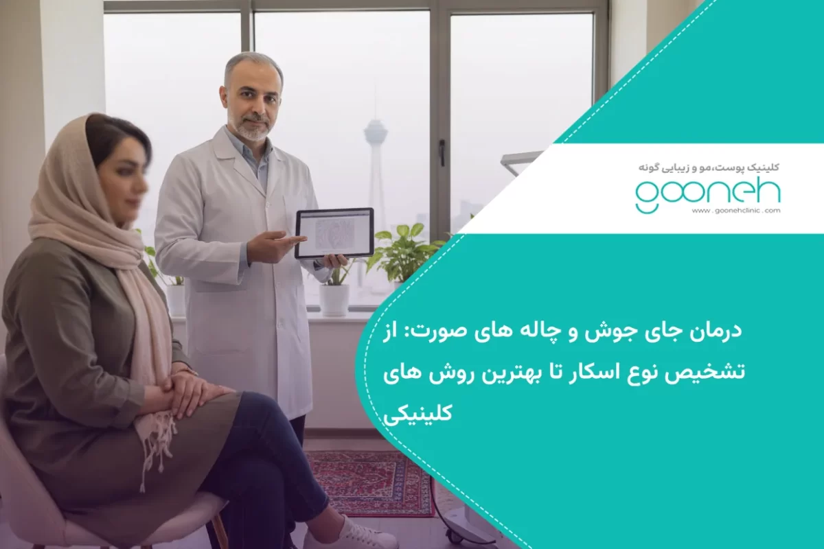 درمان جای جوش و چاله های صورت