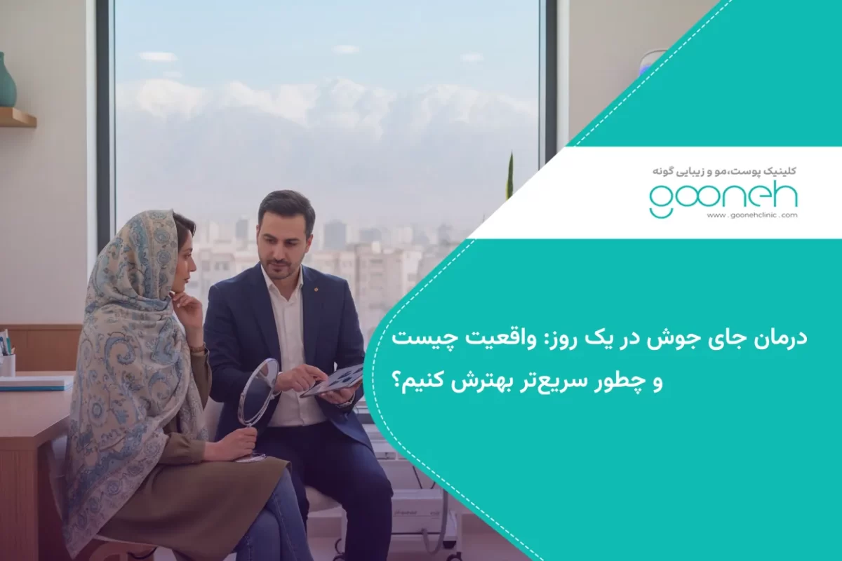 درمان جای جوش در یک روز