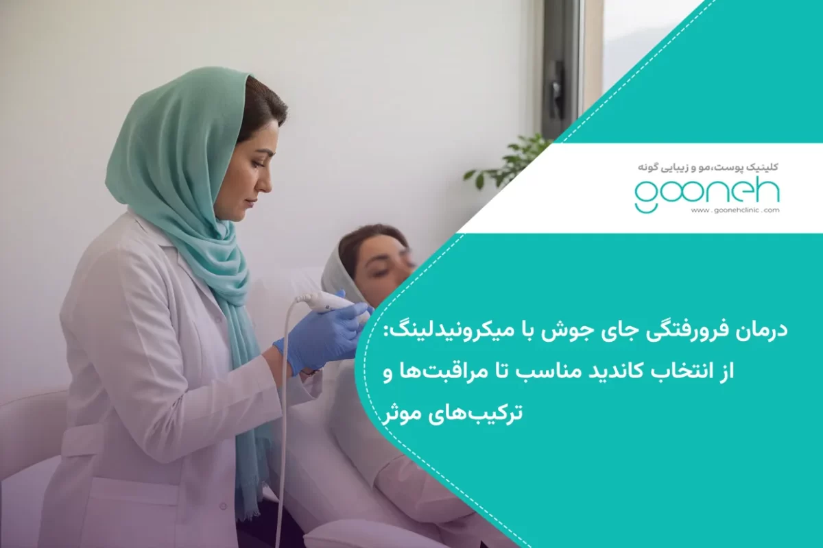 درمان فرورفتگی جای جوش با میکرونیدلینگ