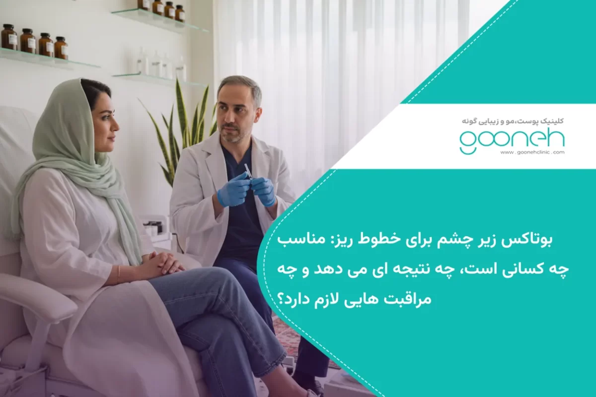 بوتاکس زیر چشم برای خطوط ریز