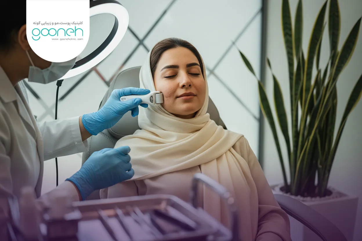 What is the best treatment for acne scars بهترین درمان اسکار جای جوش