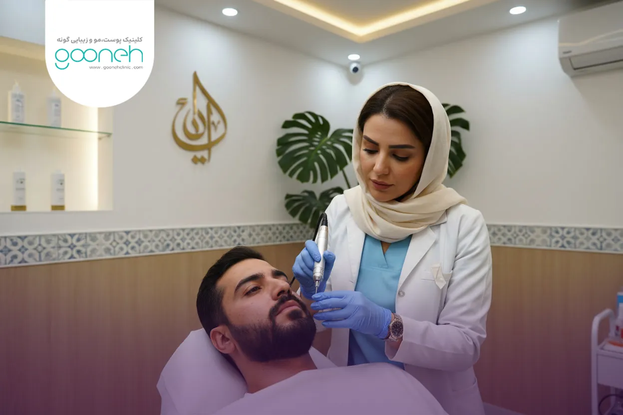 What is the best treatment to remove acne scars 1 روش های درمان جای جوش