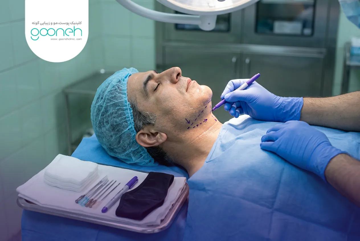 Sagging skin under the chin 1 افتادگی شدید زیر چانه و گزینههای جراحی